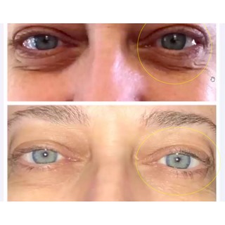 Kem Dưỡng Mắt Baebody Eye Gel 100% Authentic