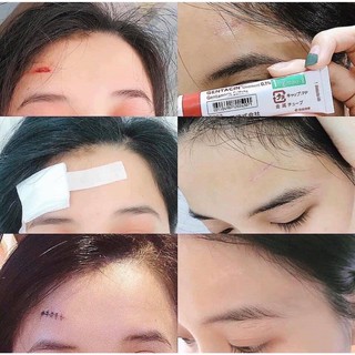 Kem sẹo Gentacin Nhật Bản