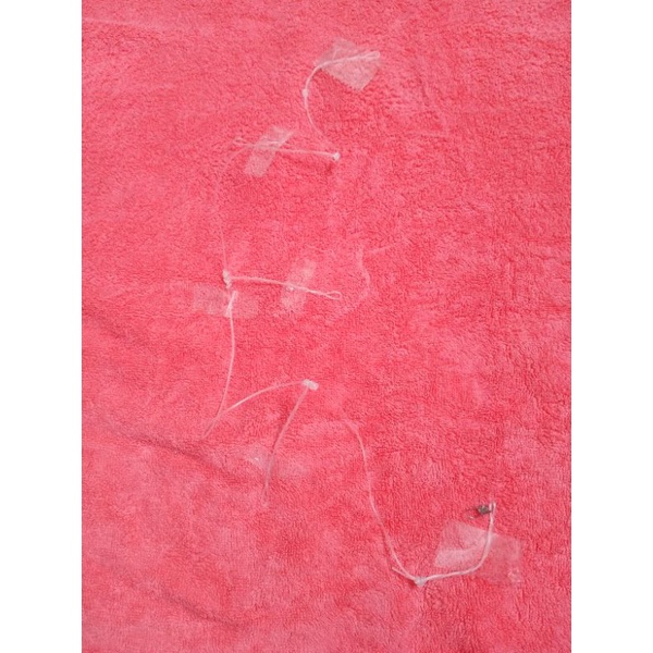 Thẻo gân 3 tầng