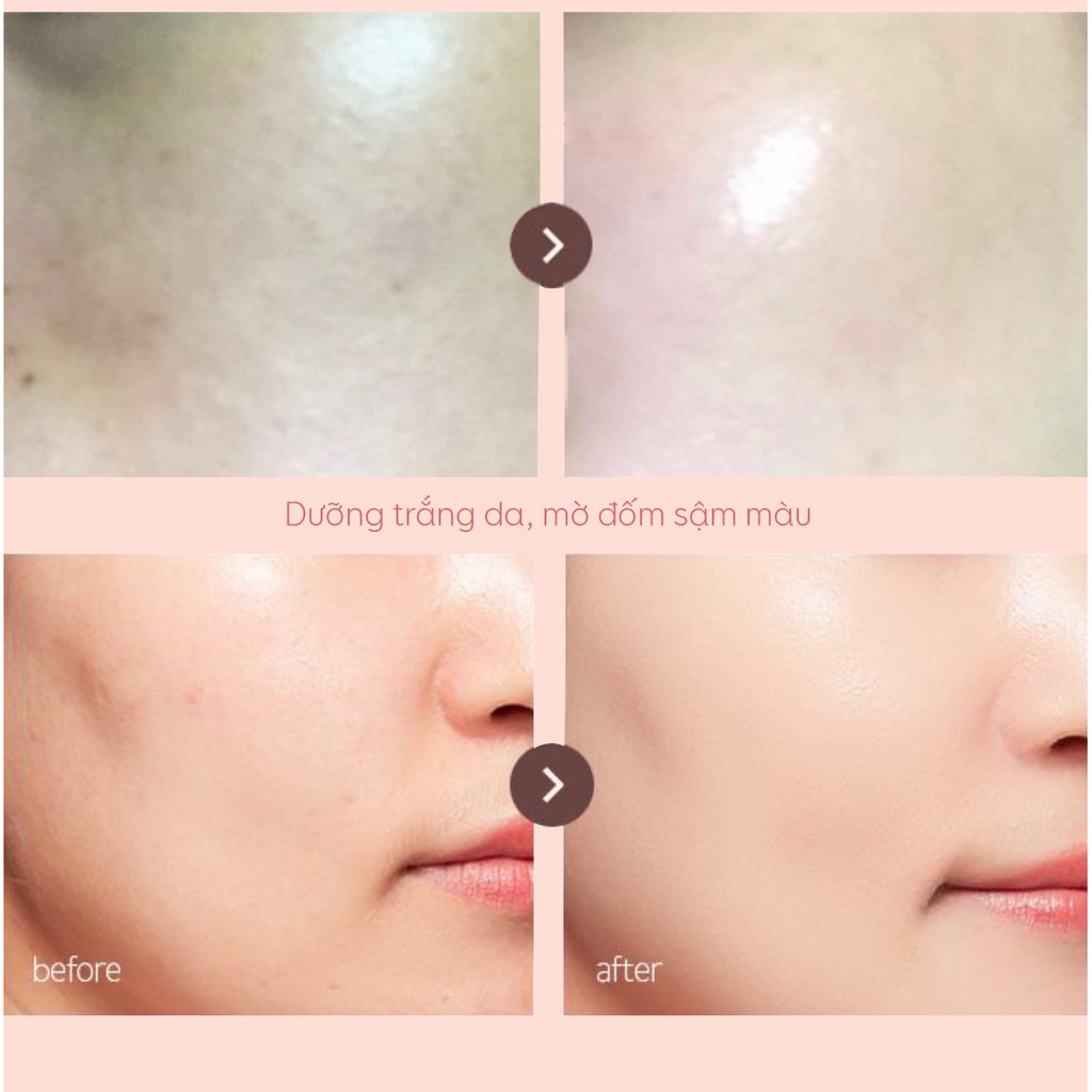 SERUM DƯỠNG TRẮNG ALPHA ARBUTIN