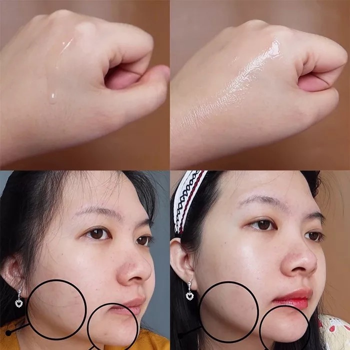 Serum Vitamin C Dưỡng Trắng Da Garnier PHÁP CHÍNH HÃNG Và Tinh Chất Ganier  Màu Xanh Giảm Mụn Thâm Nám Anti AcneJapari