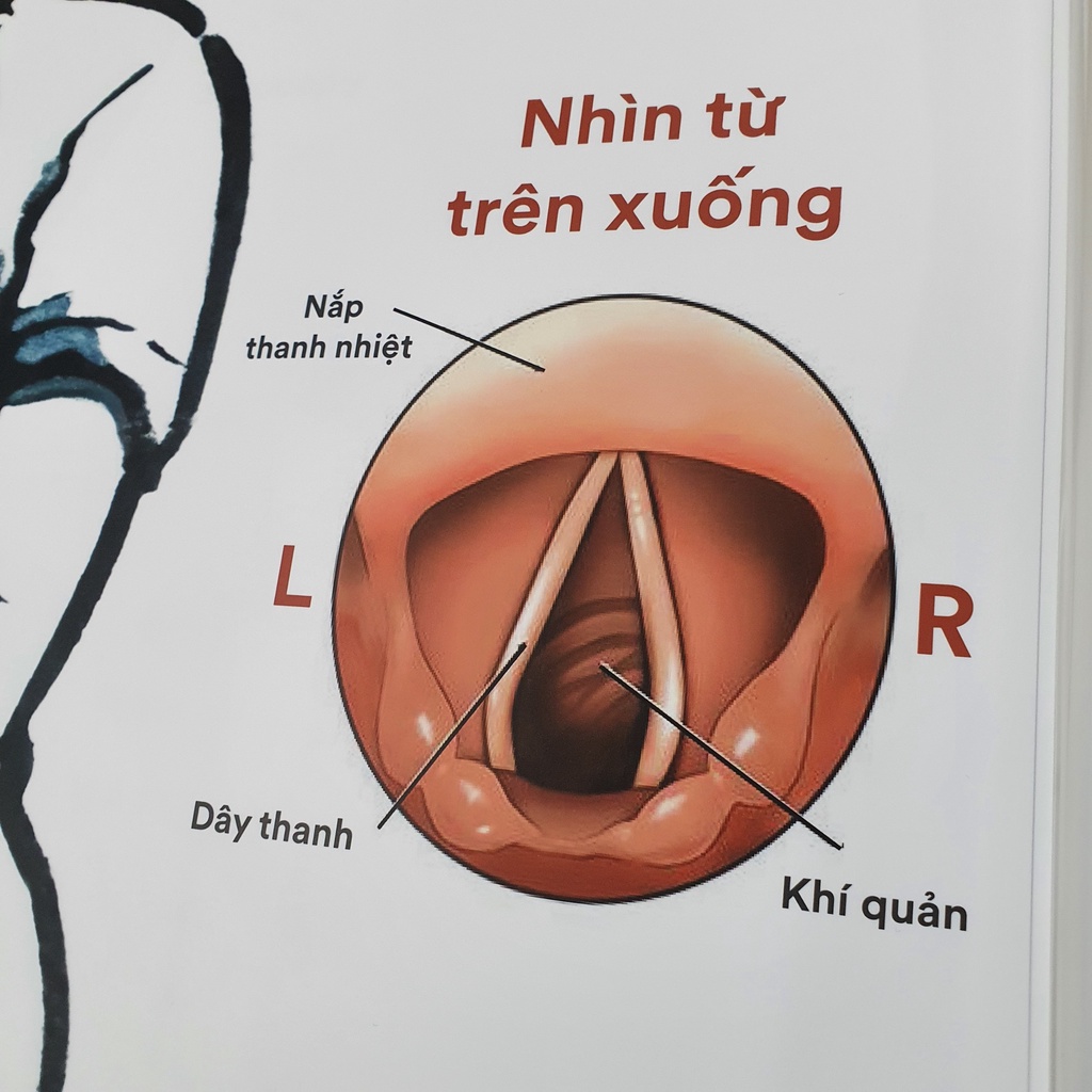 Tranh Cách bế trẻ em khám Tai Mũi Họng, giải phẫu Tai Mũi Họng- chất liệu GỖ/ MICA