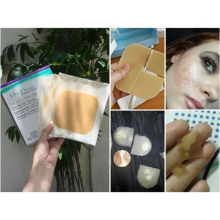 1 Miếng Dán Nhanh Xẹp Mụn DuoDerm Extra Thin 10cm x 10cm (loại to) [giá sỉ]