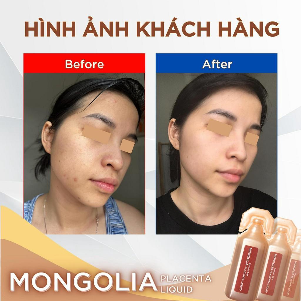 Nước Uống Tế Bào Gốc Nhau Thai Ngựa Chiến Mông Cổ Cao Cấp Mongolia Placenta Liquid