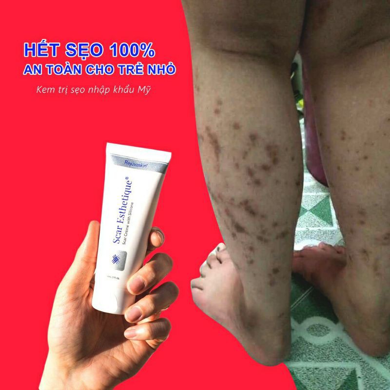 [Mã 254FMCGSALE giảm 8% đơn 500K] Kem Sẹo Scar Esthetique 60g của Mỹ