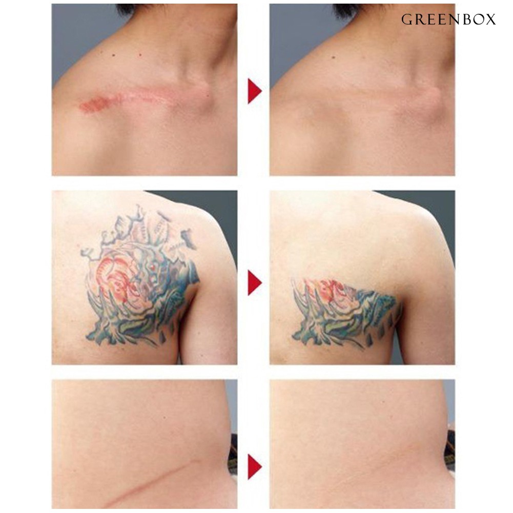 (Hàng Mới Về) Bảng Kem Che Khuyết Điểm 5 Màu Che Phủ Quầng Thâm Bọng Mắt Và Mụn Trứng Cá Hiệu Quả 5 Màu | BigBuy360 - bigbuy360.vn