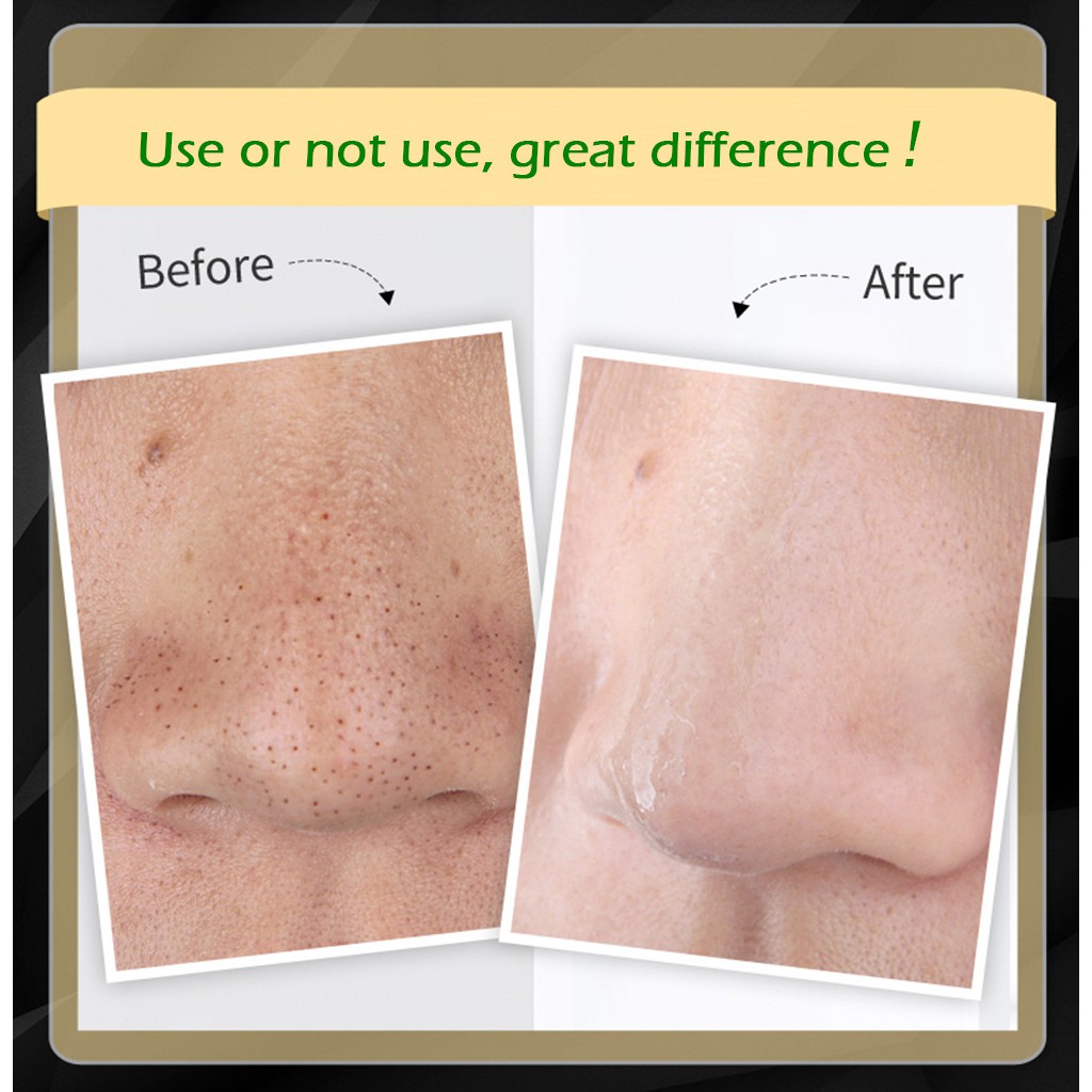 Gói Mặt Nạ Lột Mụn Đầu Đen LANBENA Blackhead Remover Mask | BigBuy360 - bigbuy360.vn