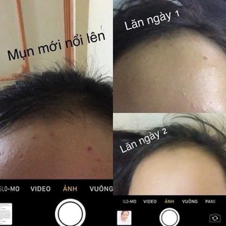 THANH LĂN MINI - NỬA LỌ NGỌC SÂM