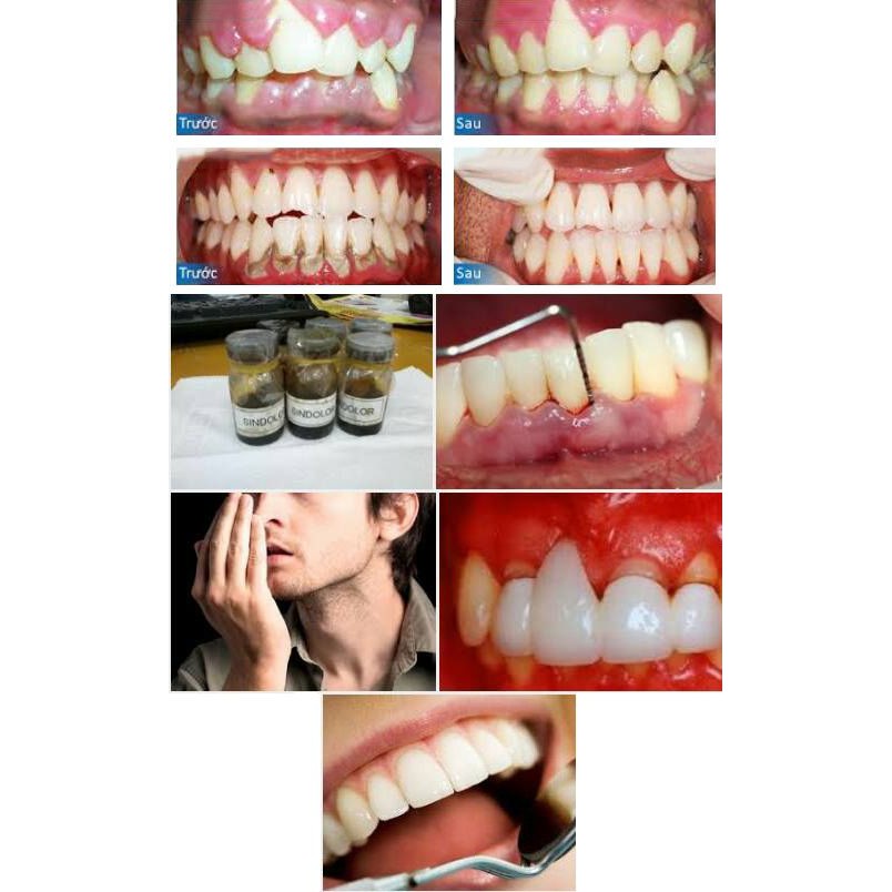 DUNG DỊCH SINDOLOR HÀNG CHÍNH HÃNG̣