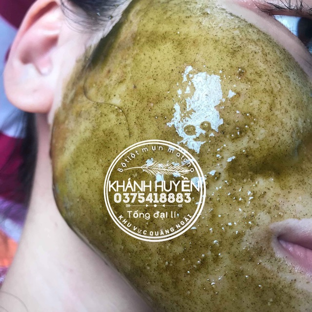 Lột mụn trà xanh