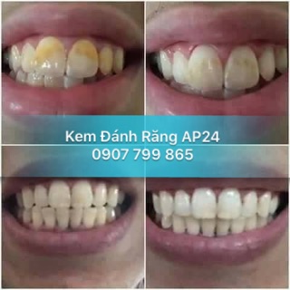 Kem Đánh Răng AP24 Ban Đêm