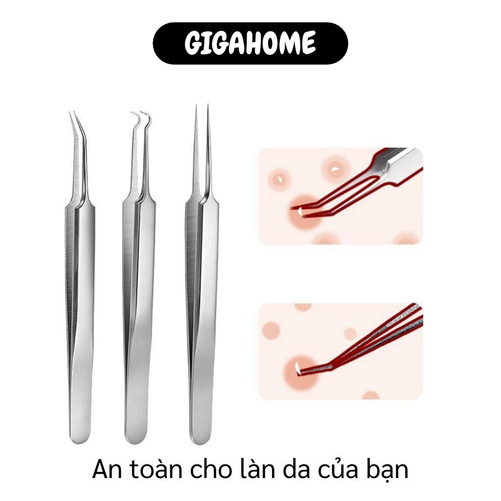 Dụng Cụ Nặn Mụn GIGAHOME Bộ Nặn Mụn 6 Món Tiện Lợi Chuyên Nghiệp Đảm Bảo Vệ Sinh, An Toàn 7522