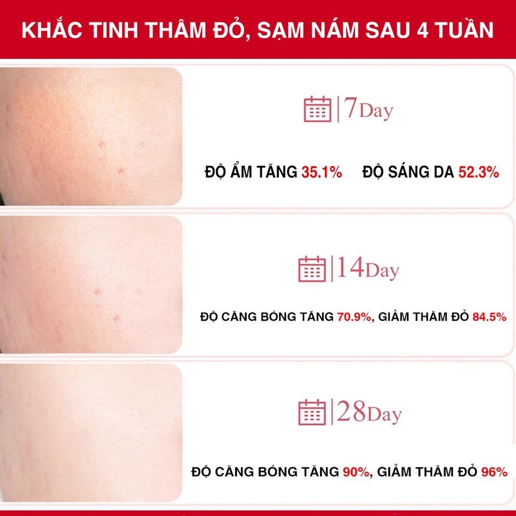 Siêu Tinh Chất Xoá Thâm Đỏ, Mờ Sạm Nám Angel's Liquid Tranexamic Mela Ampoule 30ml