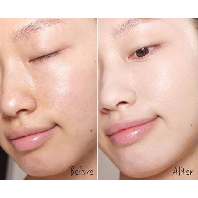 Sữa rửa mặt Meishoku Acne Bigan giảm viêm, mụn