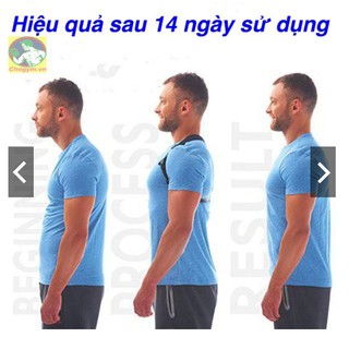 (HÀNG LOẠI 1) ĐAI CHỐNG GÙ LƯNG CAO CẤP CẢI THIỆN CỘT SỐNG