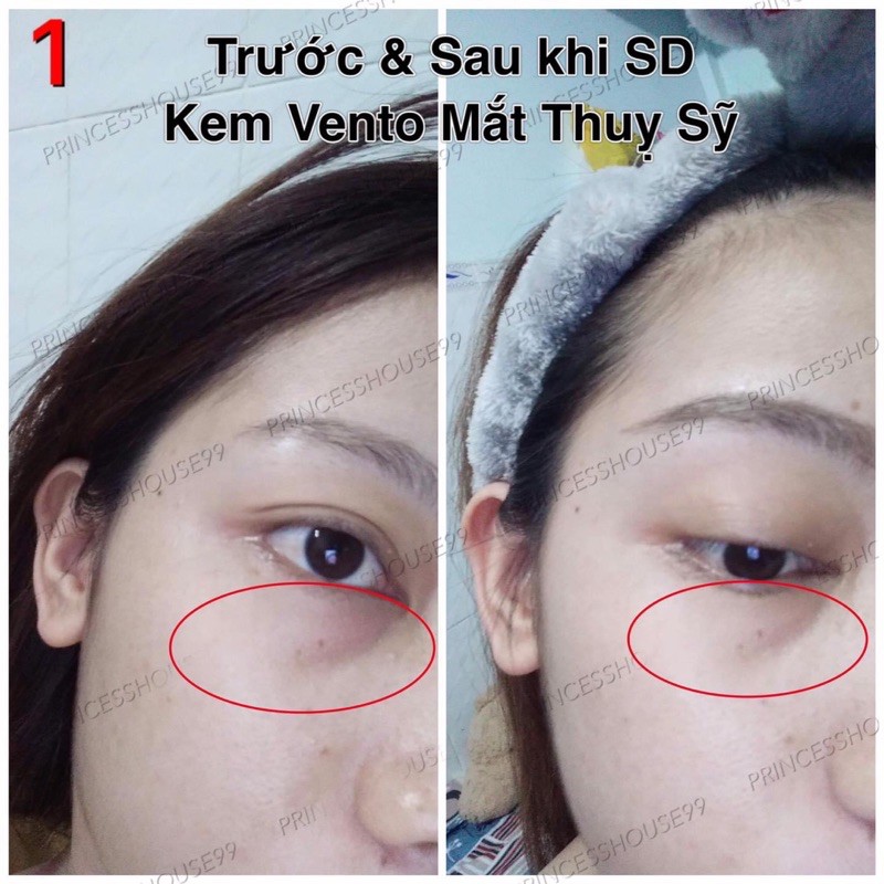 [Chính hãng] Kem  dưỡng mắt Vento vivere luxe caviar cellular eye cream