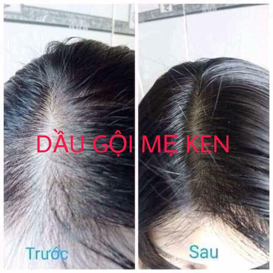 [HẾT RỤNG TÓC CHỈ SAU 2 TUẦN SỬ DỤNG] - Bộ đôi TINH DẦU BƯỞI + DẦU GỘI THẢO MỘC MẸ KEN