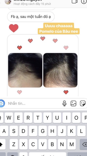 Pro POMELO Hair Mist - Xịt Bưởi Kích Mọc Tóc X2 ( Mẫu mới 2021 ) | BigBuy360 - bigbuy360.vn