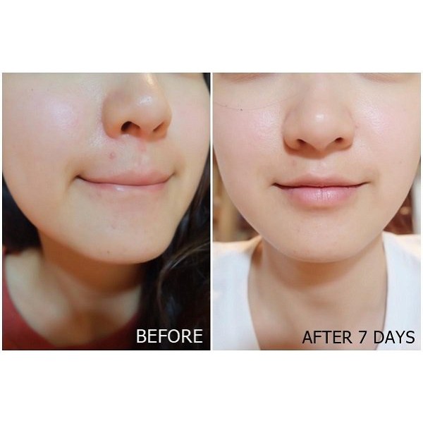 Kem Dưỡng Trắng Da Angel’s Liquid 7 Day Whitening Program Glutathione 700 V-cream