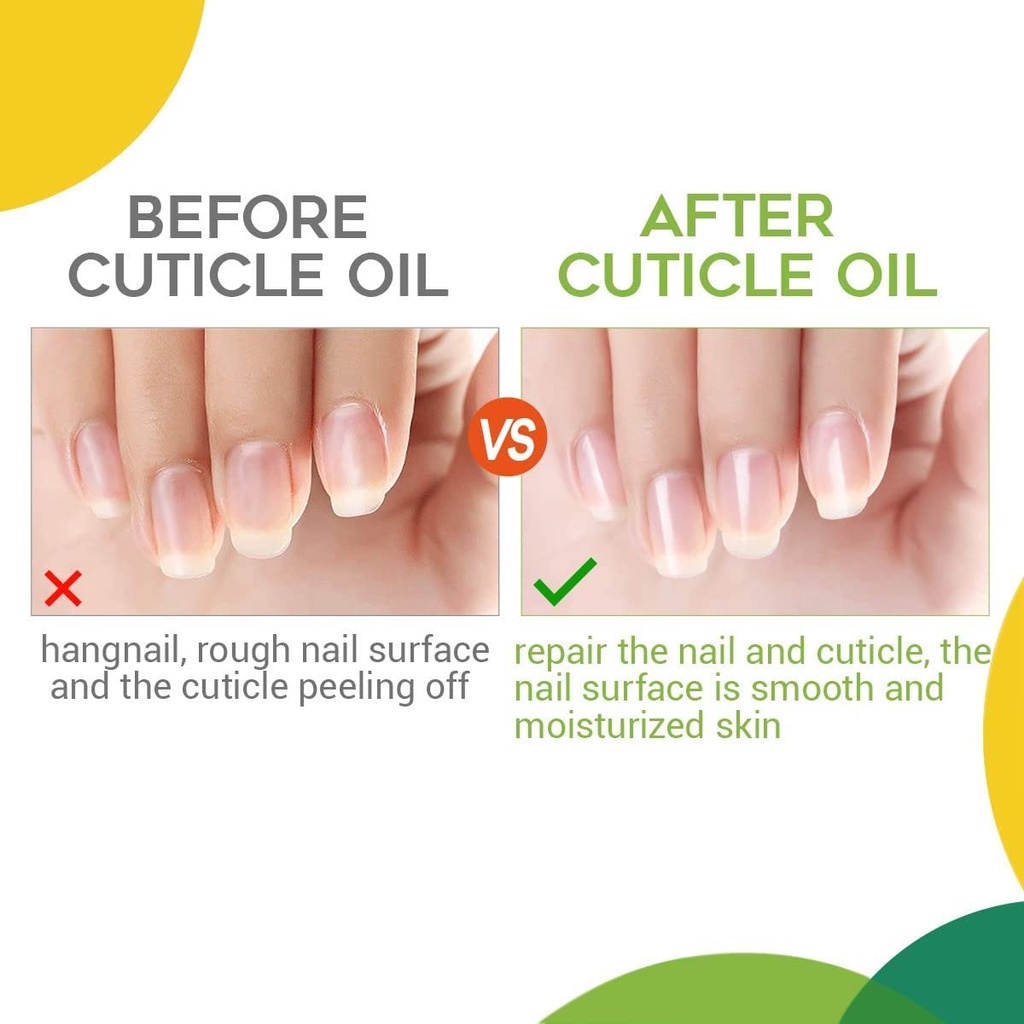 Dầu vitamin E Modelones chăm sóc móng 15ml