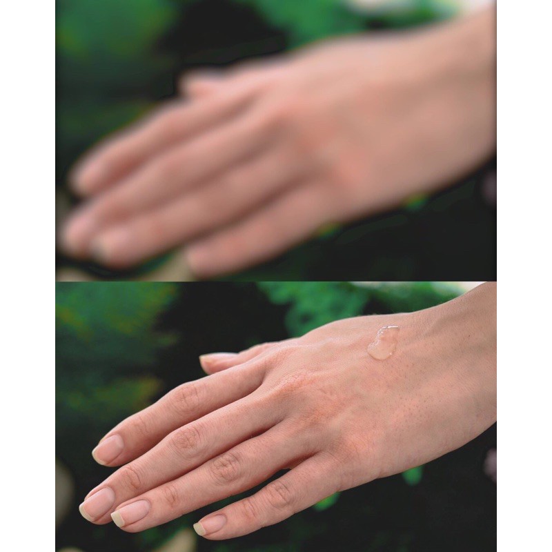 Tinh Chất Cấp Ẩm Phục Hồi SKINAVIS Hyaluronic Acid & Niacinamide + B5 | BigBuy360 - bigbuy360.vn