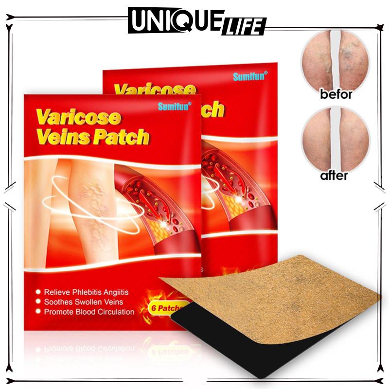 Set 12 Miếng Dán Thạch Cao Thảo Dược Hỗ Trợ Cải Thiện Tình Trạng Giãn Tĩnh Mạch Chân