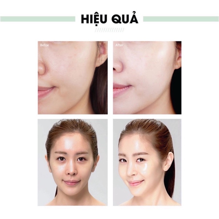 [GIÁ RẺ CHẤT LƯỢNG] [ CHÍNH HÃNG ] Serum Spot Esence Acosmetics Face Pháp | BigBuy360 - bigbuy360.vn