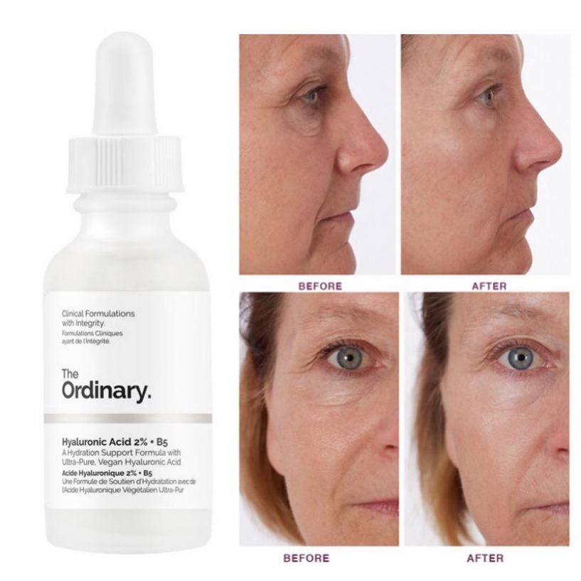 Tinh Chất Cấp Ẩm Và Phục Hồi The Ordinary Hyaluronic Acid 2% + B5 Serum