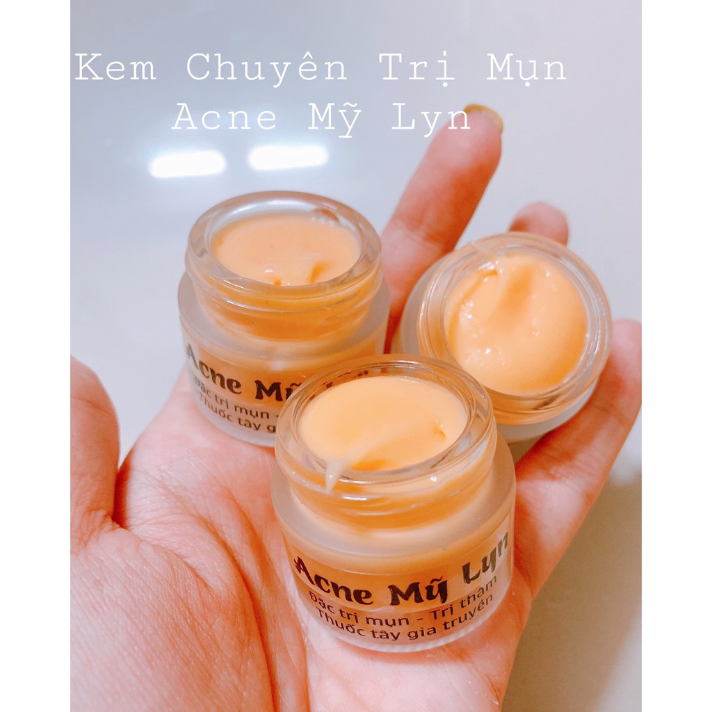 Kem ngừa mụn, giảm thâm Acne Mỹ Lyn ( Hũ lớn 10g, Hũ Nhỏ 5g) hiệu quả sau 5-7 ngày sử dụng