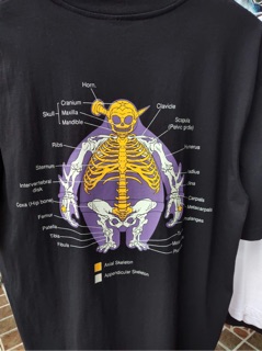 HNBMG xương