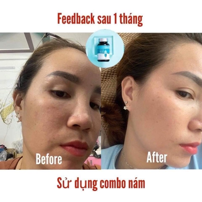 Viên uống trắng da ngừa nám GLUTATHIONE 600 Dr Lacir