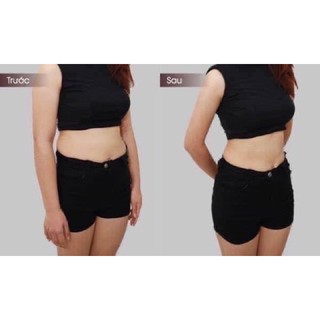 ( NEW 2018 ) KEM TAN MỠ BỤNG MISSHA HOT BURNING