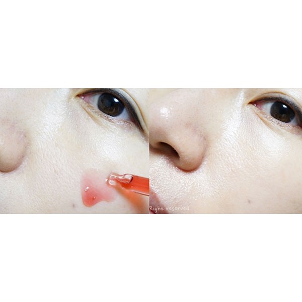 Tinh chất phục hồi dưỡng trắng sáng da, mờ vết thâm Tiam My Signature Red C Serum 30ml | BigBuy360 - bigbuy360.vn