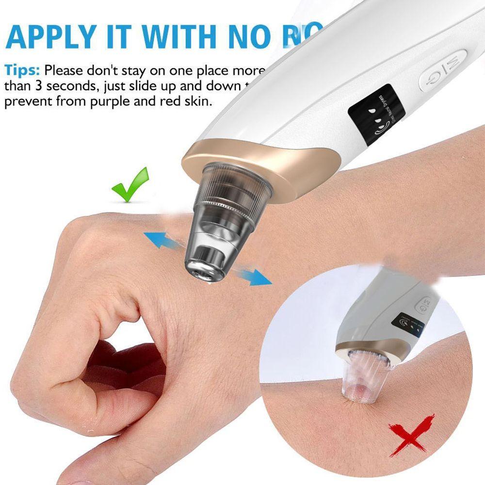 Máy Hút Mụn Đầu Đen Làm Sạch Lỗ Chân Lông