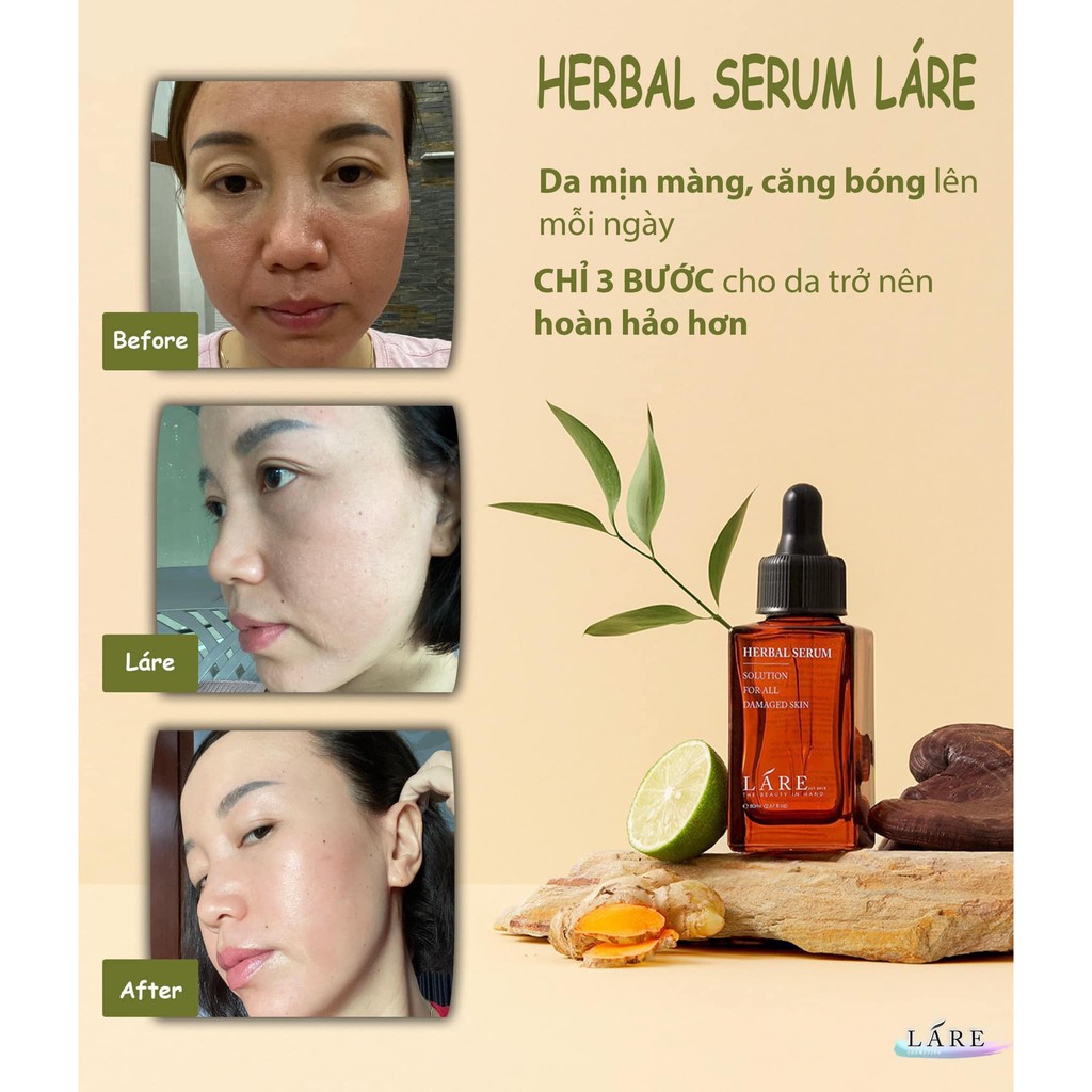 Serum thảo mộc LÁRE -THANH DƯỢC 100% thiên nhiên