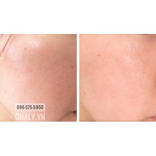 Serum Tunemakers Fullerene trắng da ngăn lão hoá 10ml của Nhật