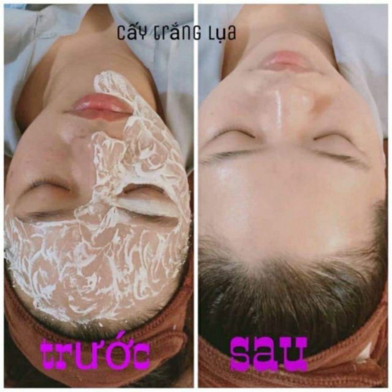 Cấy trắng lụa Nano Collagen tại nhà hoặc Spa