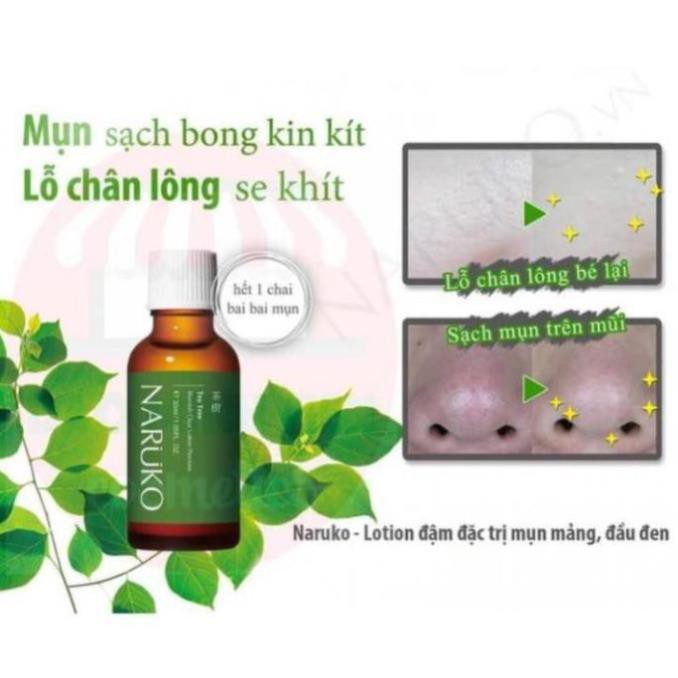 NARUKO - Lotion Tràm Trà Đậm Đặc Giảm Mụn Mảng, Mụn Đầu Đen 30ml – Tea Tree Blemish Clear Lotion Precious 30ml