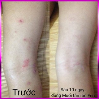 Muối Tắm Bé Sinh Dược Eco 400g (Có tem chống hàng giả)- Muối tắm bé Eco 400g tắm sạch rôm sảy, mề đay, tràm sữa