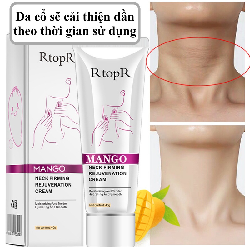 Kem dưỡng trắng da cổ RtopR Mango dưỡng ẩm, làm sáng và đều màu vùng da cổ giảm nếp nhăn và ngăn ngừa lão hóa 40g SPU100