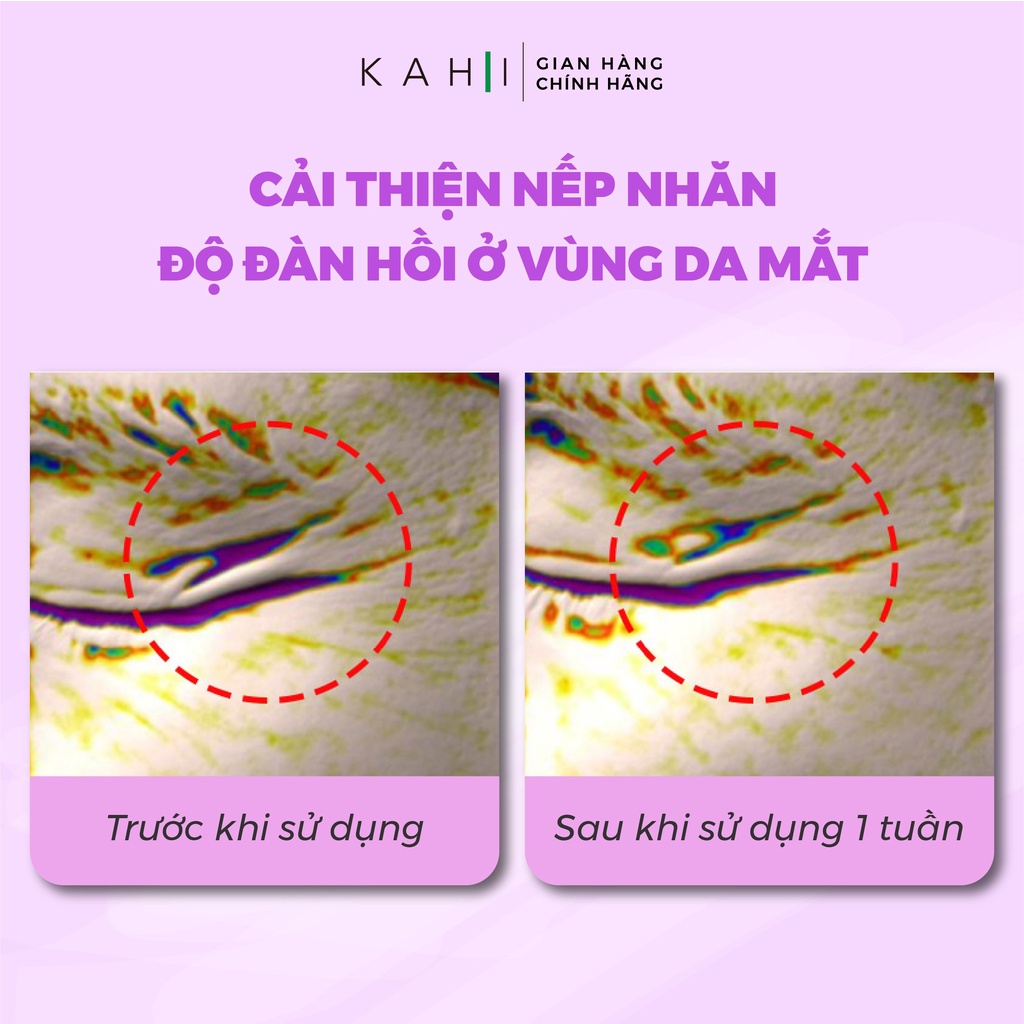 Combo 2 Kem Dưỡng Da Vùng Mắt Cải Thiện Quầng Thâm, Giảm Nếp Nhăn KAHI Eye Balm Dạng Thỏi 9g