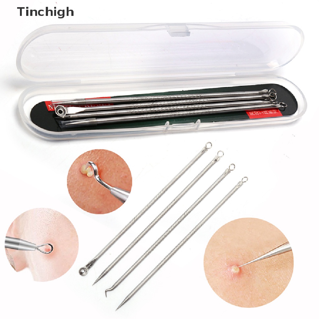 Set 4 Dụng Cụ Lột Mụn Đầu Đen Tiện Lợi Chất Lượng Cao