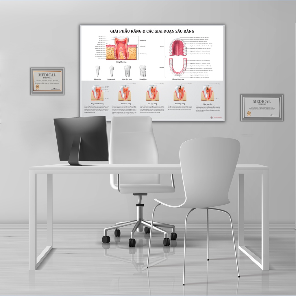 Tranh giải phẫu răng và các giai đoạn sâu răng - 50x75cm - Decal dán