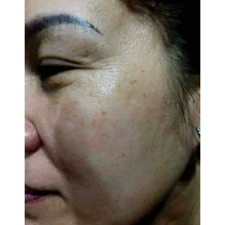 Kem Dưỡng Da💖FREESHIP💖Bộ Mỹ Phẩm Dưỡng Trắng Da Ngừa Nám YiYiMei Cao Cấp | BigBuy360 - bigbuy360.vn