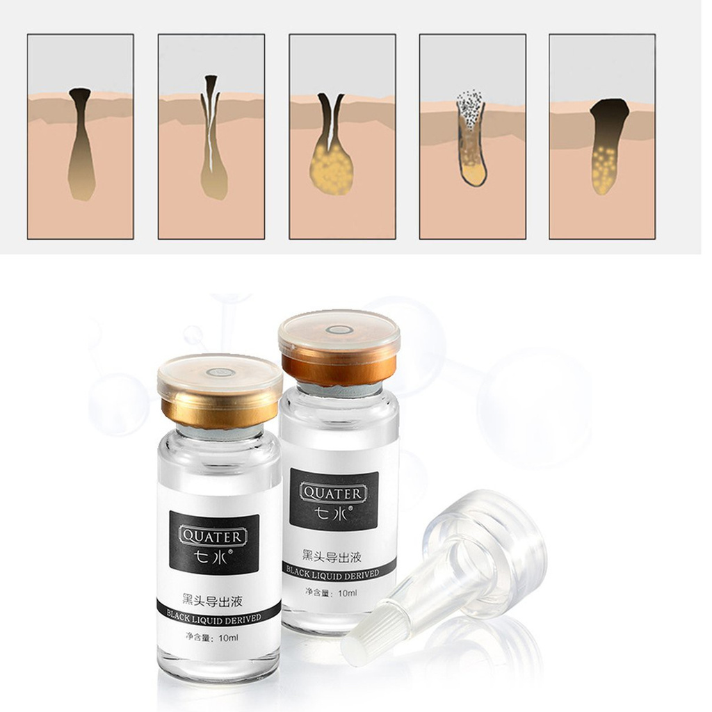 (Hàng Mới Về) Dung Dịch Làm Sạch Mụn Đầu Đen Thu Nhỏ Lỗ Chân Lông 10ml