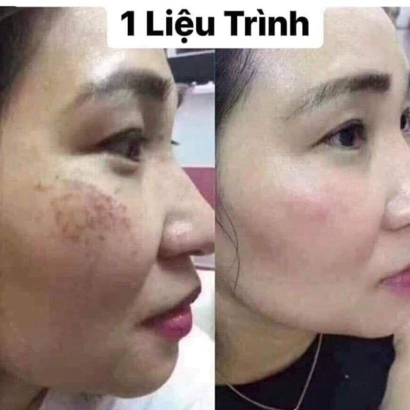 [Nguyên mã] Viên uống trắng da glutathione 600 DR_ Lacir Chính Hãng