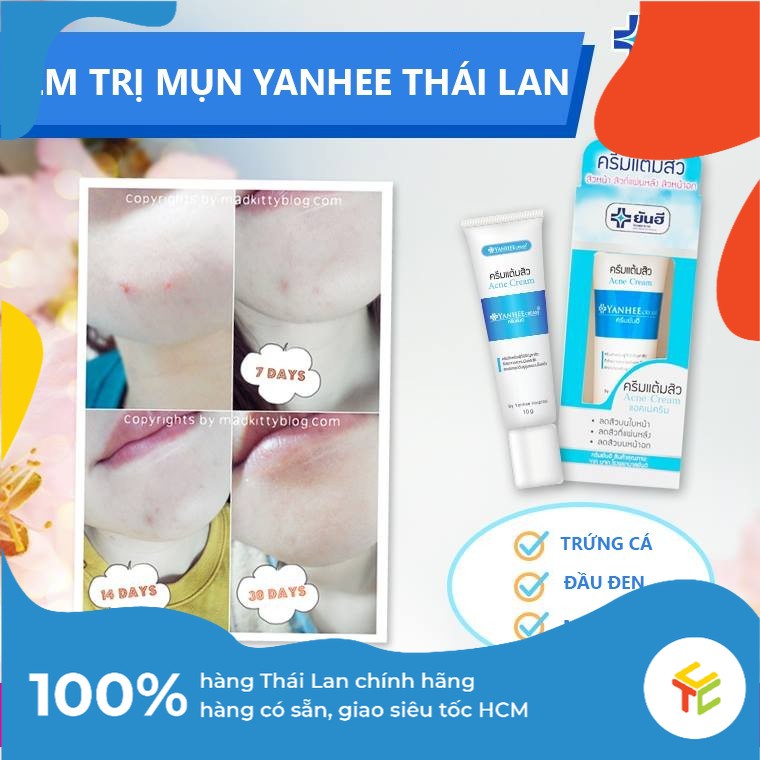 Kem Sạch Mụn &amp; Làm Mờ Vết Thâm Yanhee Acne Cream Nhập Khẩu từ Thái Lan