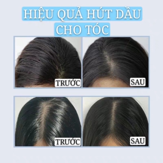 Dầu gội khô ISSY | BigBuy360 - bigbuy360.vn