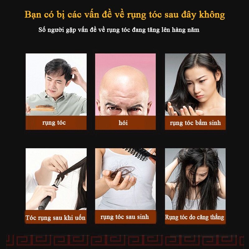 Xịt kích mọc tóc tinh dầu mọc tóc dưỡng tóc và ngăn ngừa rụng tóccó hiệu quả nhanh