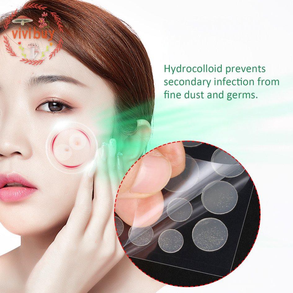 Cosrx Bộ 24 miếng dán mụn cosrx tiện lợi